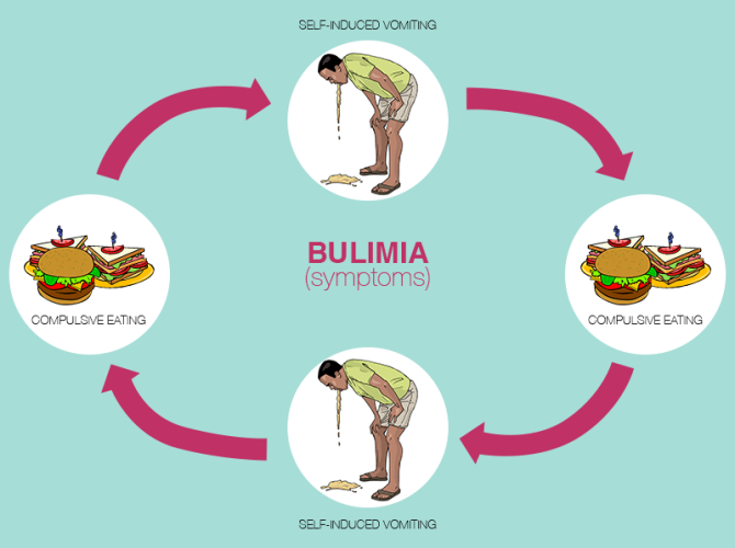 Bulimia – Disturbi Alimentari